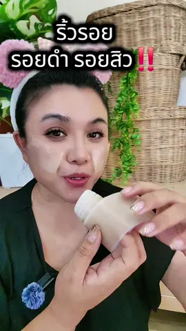 พลาสเตอร์แปะหลุมสิว #พลาสเตอร์ #พลาสเตอร์ทาแผล #แผ่นซิลิโคน 