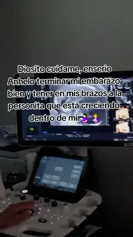 #embarazodealtoriesgo🥺 🥺🥹 #bebesprematuros💕 #ypfッ #videoviral #paratii 