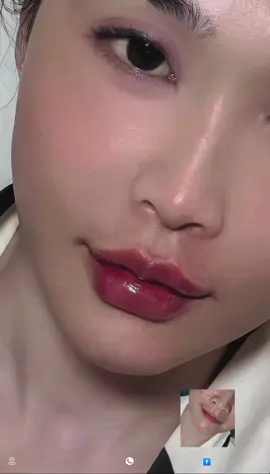 #tiemmoidep #saigon #đồngnai #fillers💉 #Nguyenhongfiiler 