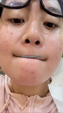 happy banget.. masker favorit aku udah ada big jar nya!!@Acnaway #acnebestie #Bigjargelmask #acnaway