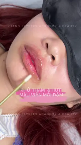 Hút màu xăm cũ bị đậm viền môi kết hợp khử thâm môi = CO2 . #giangelysees #laserCO2  #laser  #tiktok #khuthammoi 