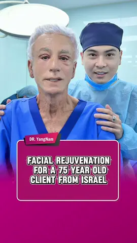 Facial rejuvenation for a 75 year old client from Israel #dryangnam #indonesia #tiktokindonesia #facelift #eyelid 