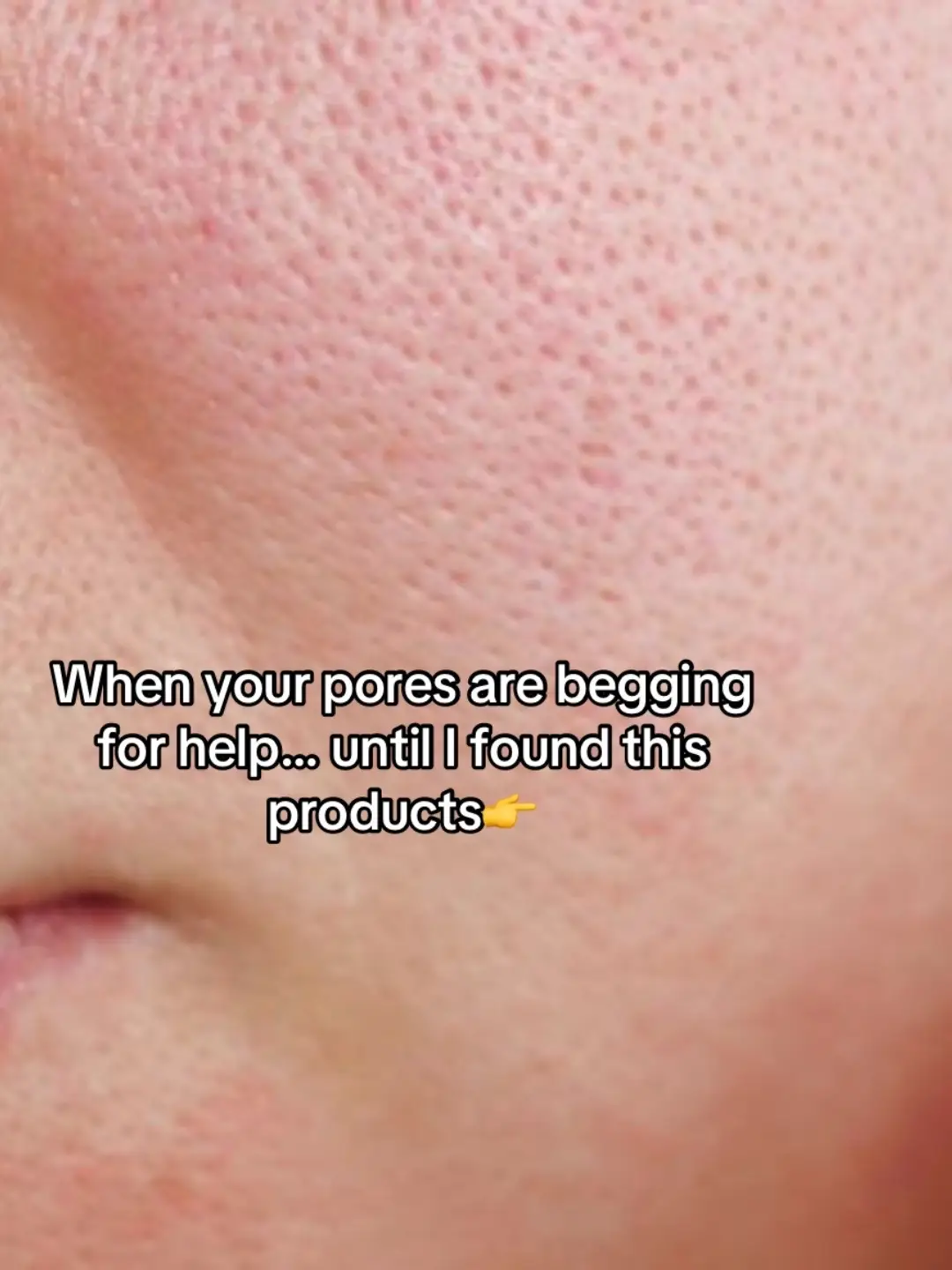 #pores #GlowUp #porepads #skincare #fyp 