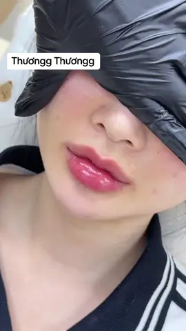 Xih cỡ này thì cái thứ gì chịu nổi đây 😪😪 #tiemfiiler #moixinh #haiphong #filler #lamdepkhongkho 