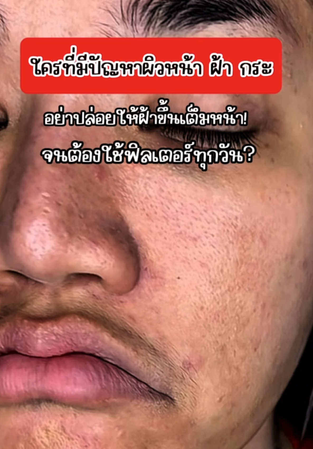 ใครเป็นฝ้าหนามาลองตัวนี้ ! #deleau #เจนนี่ได้หมดถ้าสดชื่น #เดอโลไบร์ทเซรั่ม #เซรั่มจุกแดง #เซรั่มบำรุงผิวหน้า 