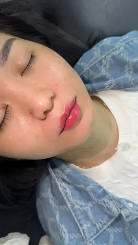 #CapCut Chuyên mục mỗi đôi môi một câu chuyện ! Nay nặn môi cho c gái, c nói trước c có qua chỗ khác tư vấn và đặt lịch làm môi rồi mà đến nơi ngta bảo môi này c ko tiem đc, tiêm xong bị hở lơi nên c bỏ hy vọng tiem môi luôn. Mấy hôm trc c thấy e chị làm bên e xong đẹp nên c lại quyết tâm thử đi xem có được không 😆 Kết quả đây ạ 🥰 #babylips #phamthuhang 