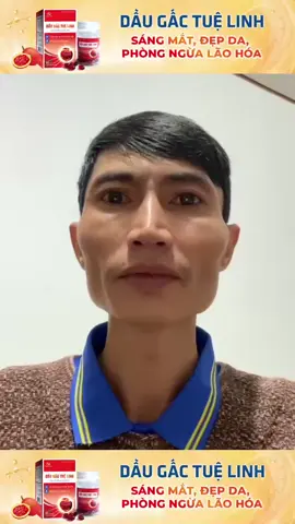 ##daugactuelinh #gac #daugac #sangmat #mat #moimat #depda #chonglaohoa #laohoa #Duoctuelinh #tuệlinh #gactuelinh