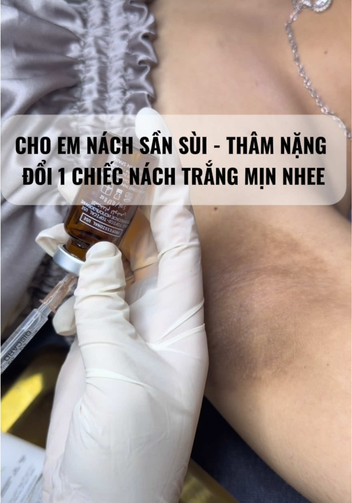 – Nách thâm do cạo, nhổ, wax lâu năm – Da sần dày, lỗ chân lông to – Mùi mồ hôi khó chịu #govap #peelnach #nachtham 