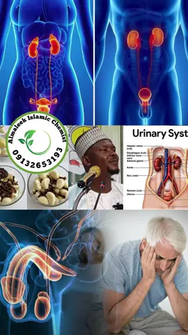 Amradul uduwi cutar sanyi @BIN YAHAYA ISLAMIC CEMIST 2 @BIN YAHAYA ISLAMIC CEMIST @BIN AFFAN ISLAMIC MED @Almaleek_Islamic_Chemist✅ @ALMALEEK HERBALS MEDICINE @D.R ALIYU AL-MALEEK HERBS 🌳🪴 #viraltiktok #viralvideos #fypage #kaduna #nigeriantiktok🇳🇬 
