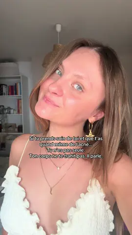 Je te le promets : tu n’es pas la seule à faire “tout bien” et à avoir quand même des poussées. Ton corps n’est pas contre toi. Il essaie de te dire quelque chose. Et tu n’es vraiment pas seule là-dedans. 🤍 #acnehormonale #tunespassepas #realite #skincarejourney #acné 