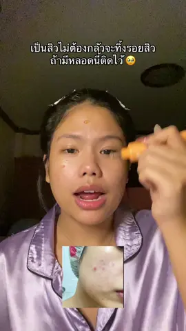 รอยเกลี้ยง ✅ #เจลมังกร #เจลมังกรลดรอยสิว #เจลมังกรblahmbooh #รอยสิว #blahmboohthailand 