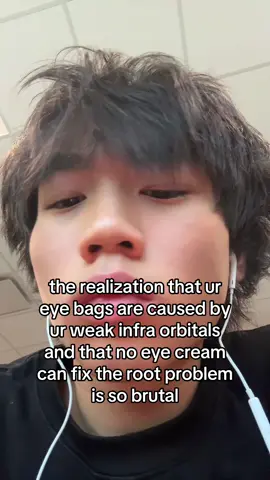 #eyebags #looks #fypシ #foryoupage #xyzbca 
