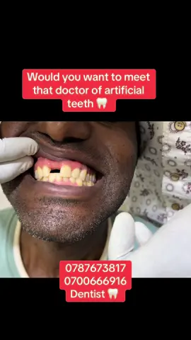 #fyp#fyp#fyp#kampala_tiktokers #kampala_uganda🇺🇬🇺🇬🤝 