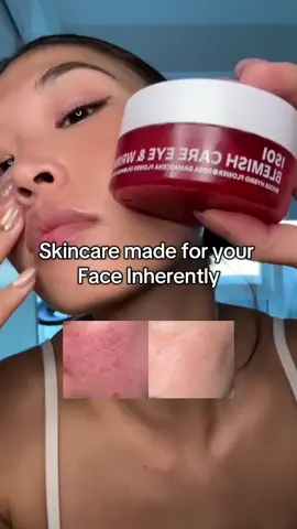 @ISOI Eye Patch #isoi #rostglow #kbeauty #eyemask 