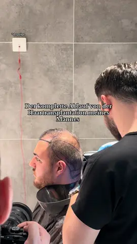 „Anzeige“ Wir sind so gespannt auf das Ergebnis. Wir danken @BioHairClinic für all das was Sie für uns getan haben. Für das Ergebnis werden wir euch bei Instagram updaten! 🙏🏻 #fyp #fyp #hairtransplantturkey #hairtransformation 