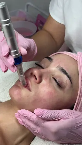 Limpieza facial profunda con hidra lips 🧖🏽‍♀️💋✨ #limpiezaprofunda #hidralips #dermapen #facial #cosmetologia 