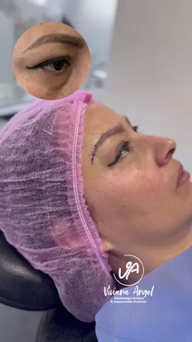 Resalta tu Mirada 🫶🏼 pexia de ceja 🙂‍↔️