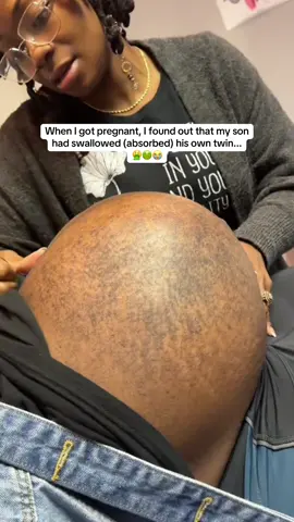 🤢 #pregnant #hospital #mother #labor #baby 