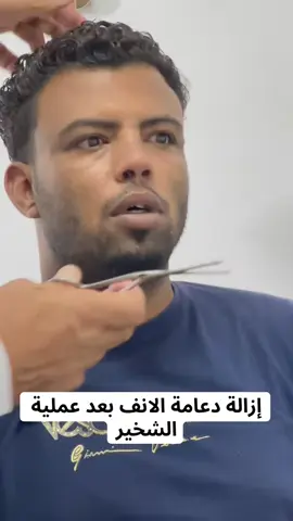 عملية الشخير مع دكتور هشام إبراهيم  #top #افضل #طبيب #اكسبلور #fyp 