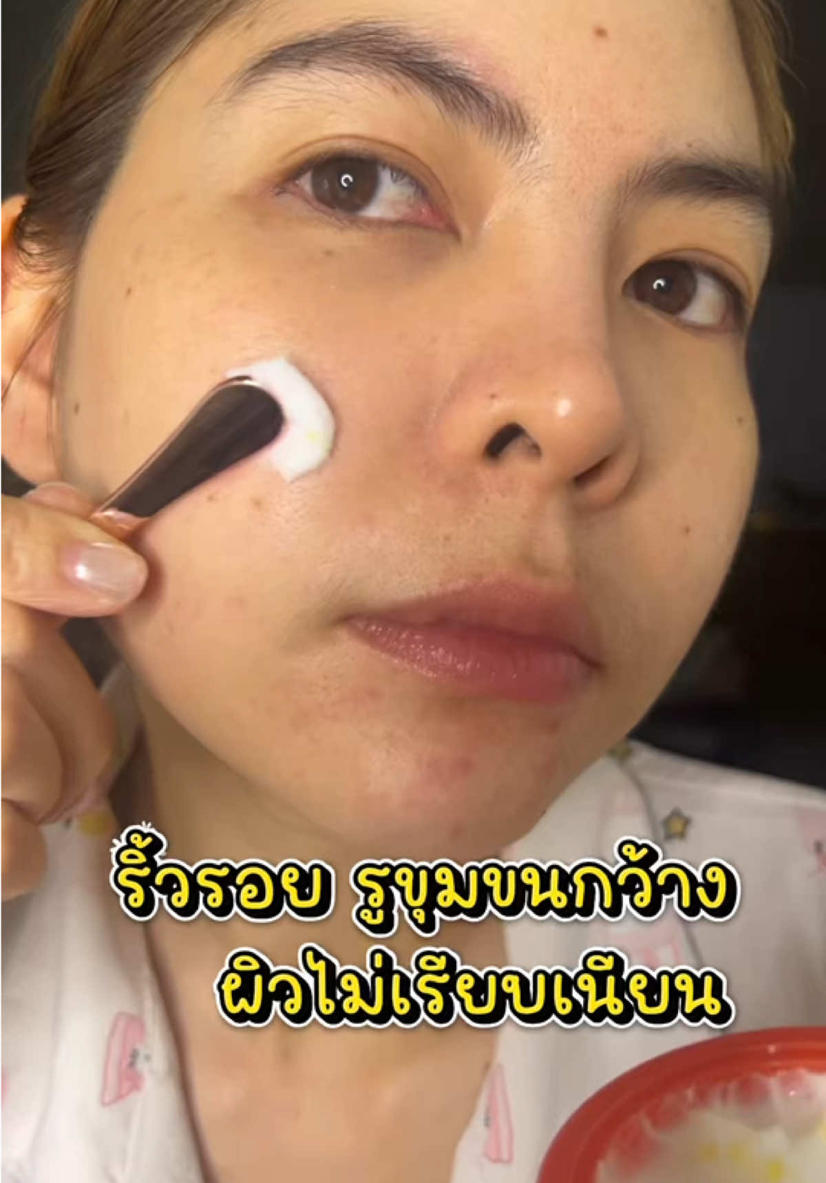 ใครที่มีปัญหาริ้วรอย รูขุมขนกว้าง ผิวไม่เรียบเนียน ต้องใช้  Ultra 5A Retinol ของ PAPA FEEL ตัวนี้เลยค่ะ👍🏻 ##papafeel##papafeelth##papafeel5a##ultra5a @@PAPAFEEL@@PAPA FEEL Offcial store