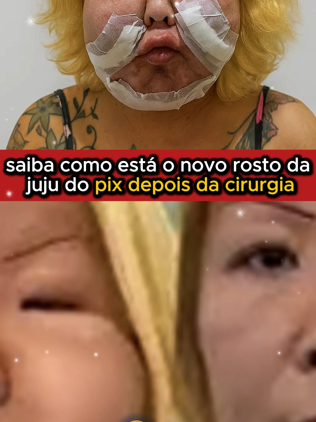 Juju do Pix pós cirurgia | Como ficou o rosto da Juju do Pix | Juju do Pix antes e depois | Juju do Pix antes e depois | Cirurgia da Juju do Pix resultado #Jujudopix
