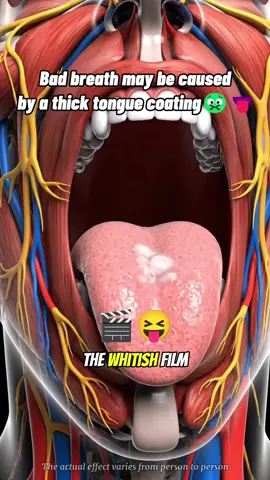 Oral Health: White teeth often indicate good oral hygiene practices.#teethwhitening #toothpastei #blackfriday