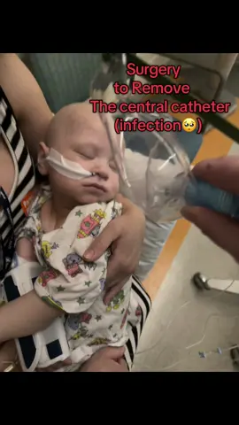 💛💛Castiel’s surgery went ok. He came out of anesthesia in distress and it took a while to help settle him. We had to have more pain medicine given and we noticed one of his new IV’s had already come out and was sweeping and bruising in his forearm. The nurses removed the one IV and after a couple hours he calmed and was exhausted. He fell asleep early today, but he is free of his central line… until a new one is placed on Tuesday.  #hope #surgery #neuroblastomastage4 #cancer #Castiel 