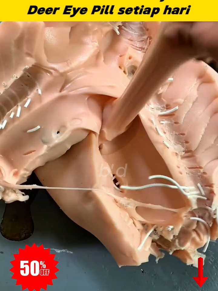 11.22yxw-lyw-MY-Jika anda kerap mengalami keradangan mata, kekaburan, dan penglihatan kabur, anda pasti patut mencuba ini.#sakit #sakitlututsendi #penjagaankesihatan #pelindungmata -635696