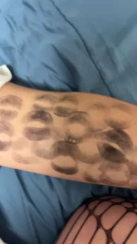 Hehehehe ☺️ #fyp #couple #kiss #alt #alternative 