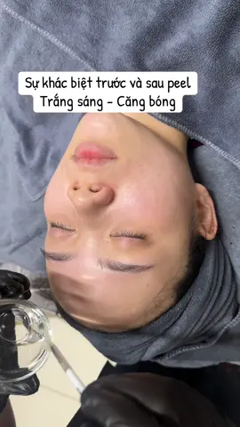 Peel Căng Bóng - Trắng Sáng #daotaohocvien #peelda #trắngda #xuhuong 