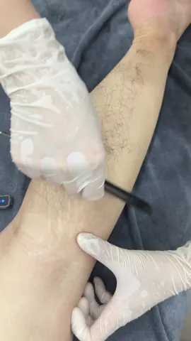 Thử cân tạm mặt sau xem được mấy kí lông rui 🌚🌚 #fyp #spa #trietlongbacninh #tulab #tulabclinic 