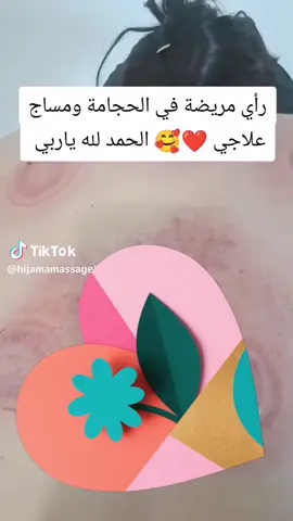 #🌿✨ حجامة نساء – مكة المكرمة ✨🌿 خدمة راقية… خصوصية تامة… وأيدي خبيرة! نوفر جلسات حجامة للنساء في مكة بإشراف مختصة مرخّصة، مع الالتزام التام بالتعقيم ووسائل الأمان: ✔️ حجامة شرعية ✔️ حجامة جافة ورطبة ✔️ أدوات معقمة للاستخدام لمرة واحدة ✔️ جلسة هادئة ومريحة ✔️ إمكانية الزيارة المنزلية داخل مكة نهتم براحتك أولاً… ونوفر لك تجربة آمنة ومريحة في بيئة خاصة بالكامل 🌸 📞 للحجز والاستفسار متاحين طوال اليوم 🚚 خدمة داخل جميع أحياء مكة #حجامة_نساء_مكة #حجامة_مكة #مختصة_حجامة #حجامة_منزلية