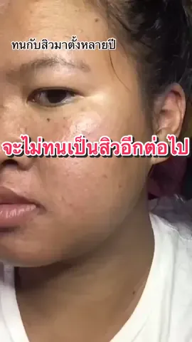 จะไม่ทนอีกต่อไป #สบู่เนริสต้า #ฟีดเถอะขอร้อง #ฟีดเถอะ #ฟีดดดシ #fyp 