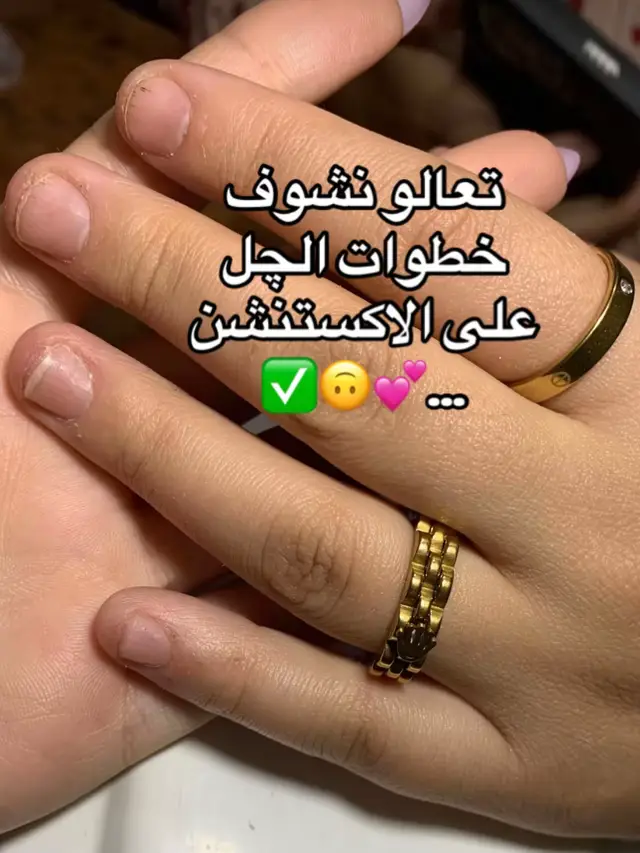 #سودانيز_تيك_توك #الشعب_الصيني_ماله_حل😂✌️ #nils #كسلا_بورتسودان_قضارف #عطبره_بلد_الحديد_والنار #sudanese_tiktok #فن_اظافر #foryou #tpyシ #foryoupage #f #fy #اظافر_اكريليك #اكسبلورexplore #اظافر_تركيب 