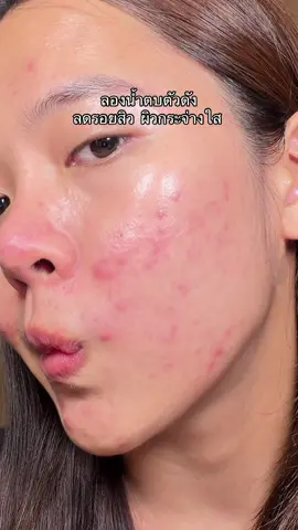โอเค จด ! #skincare #tiktokป้ายยา #น้ําตบลานอส 