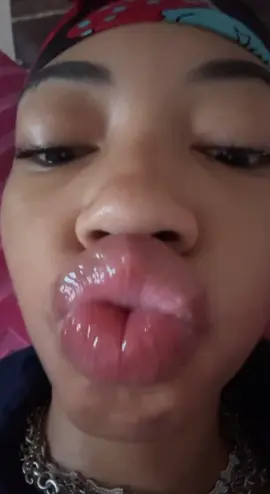 #plumplips #biglips #prettylips #dsls ##braces 