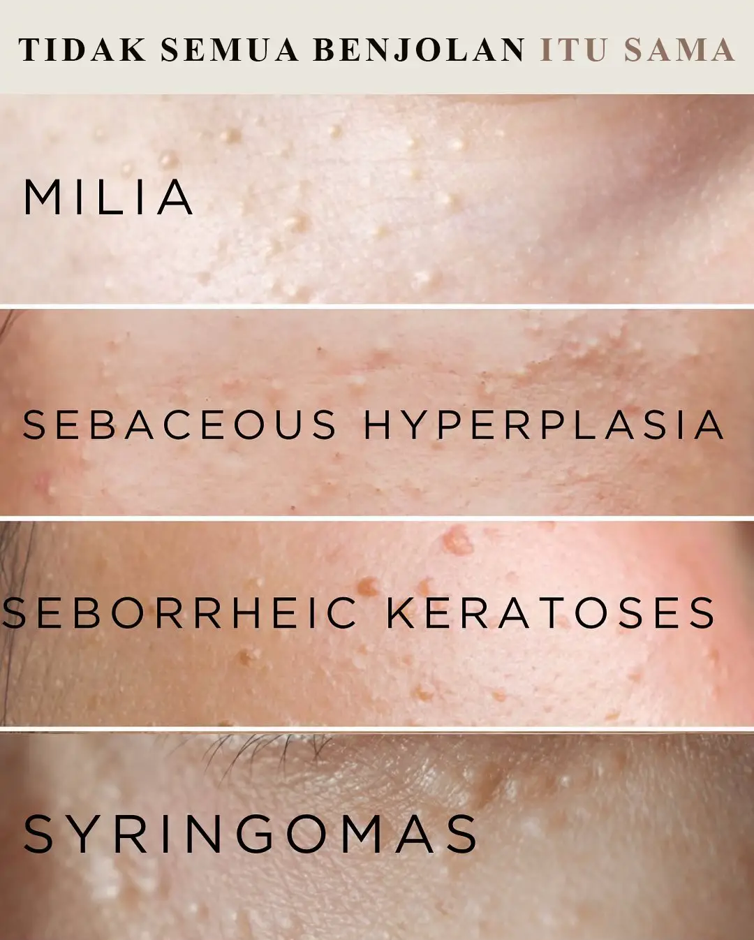 Bnyk yg dm djelasin dsni aja ya..