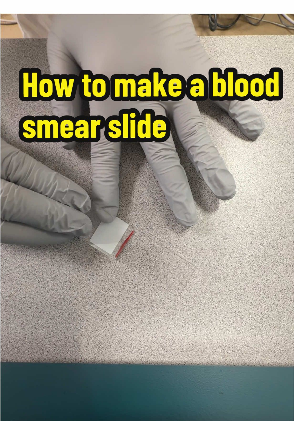 How to make a slide :) #hematology #slide #lab #pathology #medtechtok 