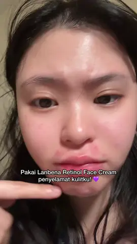 auto glowing pas make moist dari @Lanbena.Indonesia #trulyagingtrulyradiant #lanbena #lanbenaretinolcream #gaktakutmenua #antiaging 