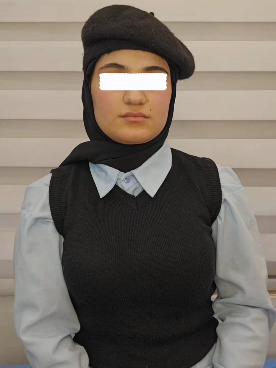 #نتيجة #تجميل #تجميل_الأنف #مجمع_النور_الطبي #ترقبوا 