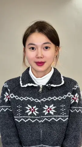 thay đổi cho bé khách đi chụp ảnh cưới #filler #botox 