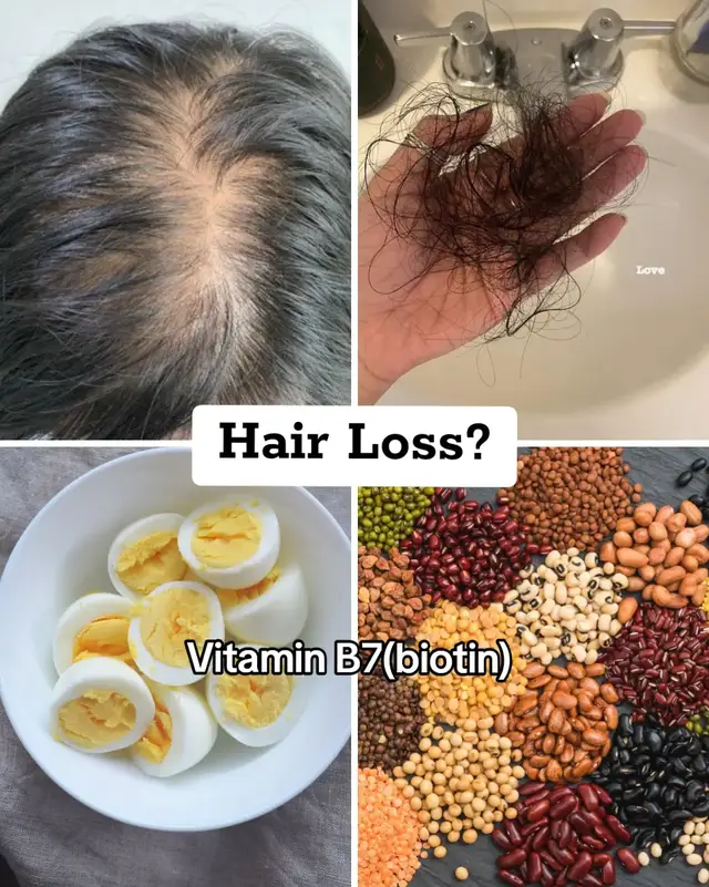 #fyp #vitamin   #healthytips  #viral  #reviewbyjuu 