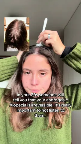 ❤️ #alopecia #hairloss #chutedecheveux #hairthinning #alopecialife 