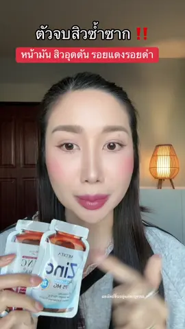 ตัวจบ #ซิงค์ลดสิว #ซิงค์ลดสิวรอยสิว #ซิงค์วิตามินซีพลัส #ซิงค์วิตามินซี #ซิงค์ลดผมร่วง      