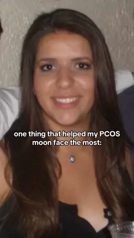 Inositol dramatically improved my PCOS moon face & helped me get my period back! Because of insulin resistance, I had a lot of water retention in my face, hands and feet. #pcos #pcoslife #pcosweightloss #pcosawareness #pcosdiet   