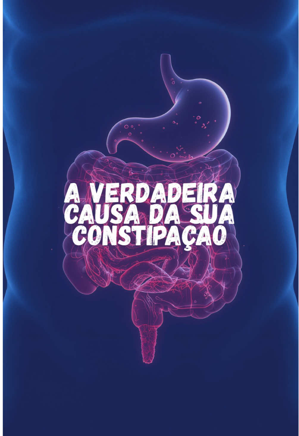 A constipação acontece quando o intestino fica lento demais. Isso pode rolar por vários motivos: pouca fibra na alimentação, baixa ingestão de água, sedentarismo, uso de alguns medicamentos e até prender a vontade de ir ao banheiro por muito tempo. Quando o intestino demora pra empurrar o bolo fecal, o cólon reabsorve mais água do que deveria — e as fezes ficam duras, secas e difíceis de sair. Resultado? Desconforto, distensão abdominal e esforço para evacuar. A boa notícia é que, na maioria das vezes, dá pra prevenir: beber mais água, consumir fibras, manter uma rotina intestinal e movimentar o corpo já ajudam MUITO! 🥦🚰🏃‍♂️ #constipacao #prisaodeventre #intestinopreso #medicina 