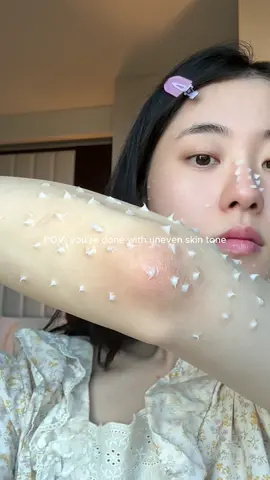 I'm literally done with uneven skin tone! #txa #hyperpigmentation #darkspots ##darkelbows##axisy @@AXIS-Y