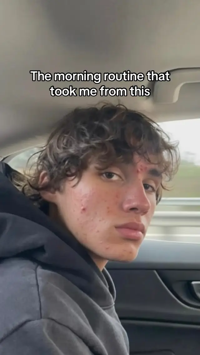 4 steps, thats it. keep it simple bro #acne #looksmax #acnetips #skincare 