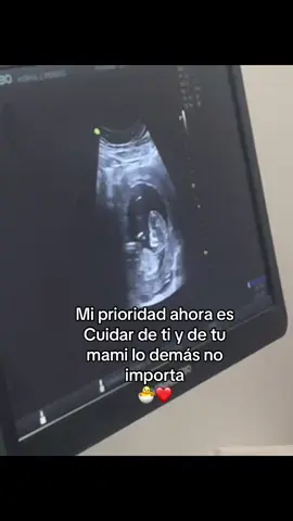 Te amo mi corazoncito 🐣❤️‍🩹🥹@xioo30 #fyp #parati #bebestiktoks #viral_video 