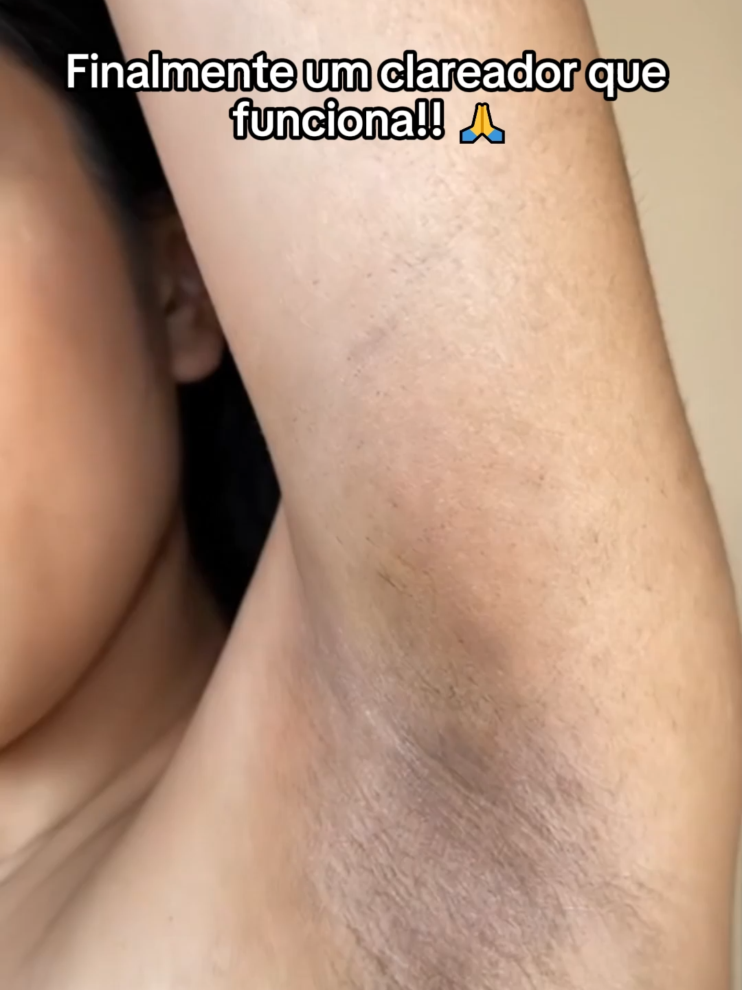 Finalmente um clareador que clareou minhas axilas! #maxfem #serum #clareadordemanchas